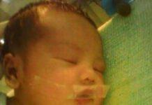 Il neonato piange, infermiera gli tappa bocca con scotch