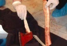 Barbaria in Sicilia, ragazzo difende la fidanzata da molestie e viene aggredito a colpi di accetta