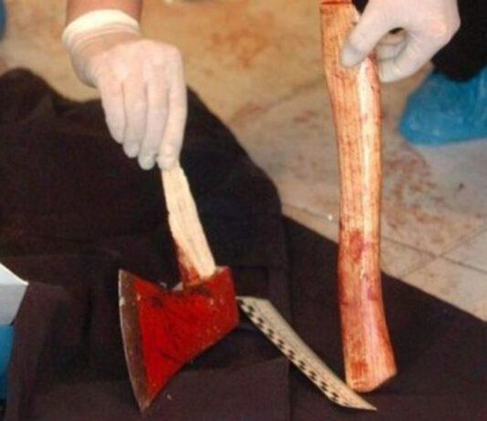 Barbaria in Sicilia, ragazzo difende la fidanzata da molestie e viene aggredito a colpi di accetta
