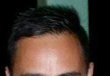 Lamezia Est, Feroleto (CasaPound): Disagi su via Tommaso Fusco