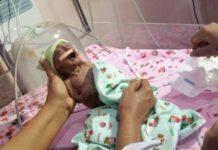 Bimba nasce prematura e malata, genitori la abbandonano “spaventa il fratellino”