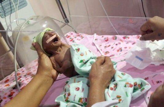 Bimba nasce prematura e malata, genitori la abbandonano “spaventa il fratellino”