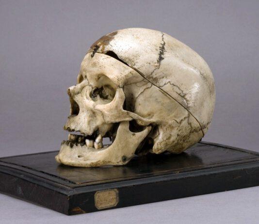 Il cranio del brigante Giuseppe Villella, simbolo della questione meridionale, va restituito alla Calabria