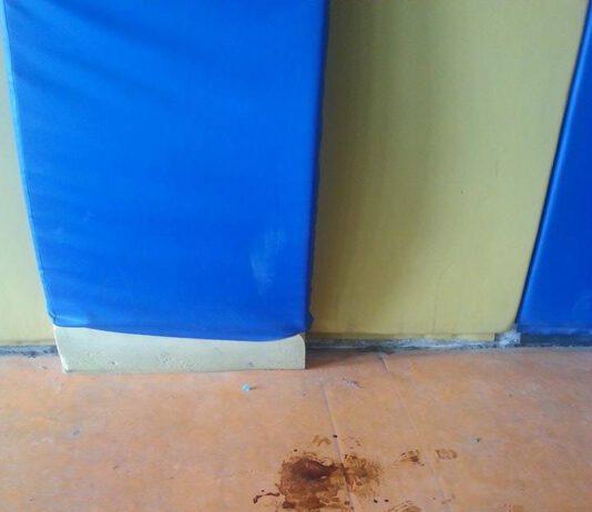 Rosarno… discarica aperta