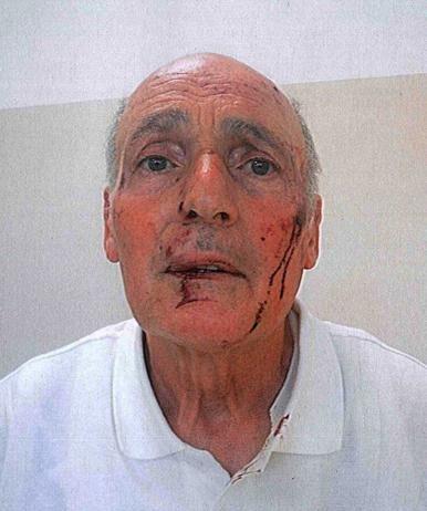 Botte tra preti in seminario. Accuse di furto e aggressioni a colpi di sedia