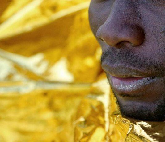 Migrante con arti amputati, cure da servizio sanitario nazionale