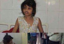Trovata in India bimba “Mowgli”, a 8anni viveva con le scimmie