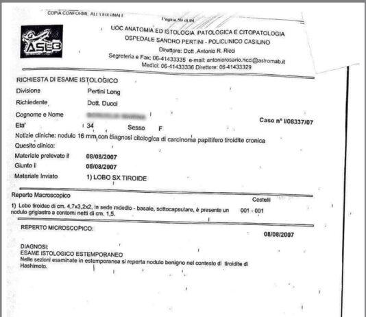 Malasanità- operata per tumore tiroide ma era infiammazione