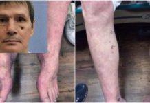 Non trovano vene per iniezione letale, rinviata esecuzione morte