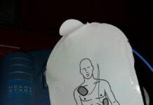 Rosarno, scomparso defibrillatore da campo sportivo