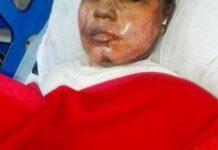 Non si converte islam, il promesso sposo le dà fuoco