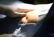 Medicina rigenerativa, presto un “tetris biologico”