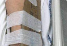 Reggio Calabria fasciature ortopediche con cartoni