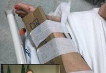 Enza Bruno Bossio su cartone come gesso ospedale Reggio: “Il Paziente era arrivato così in Ps”