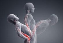 A Reggio Calabria visite gratuite per chi soffre di spondilite anchilosante