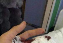 Egiziano stacca dito a morsi ad agente di Palmi