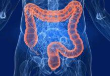 Malattie Infiammatorie Croniche Intestinali in aumento, anche per i più piccoli. Nuovi gli approcci terapeutici