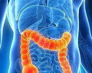 Vaccino contro il tumore al colon-retto. Una speranza a Reggio