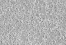 Coronavirus isolato allo Spallanzani- Speranza: “Ora piu’ facile trattarlo”