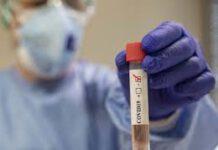 Coronavirus- Bollettino regione Calabria, 351 i positivi, 11 morti