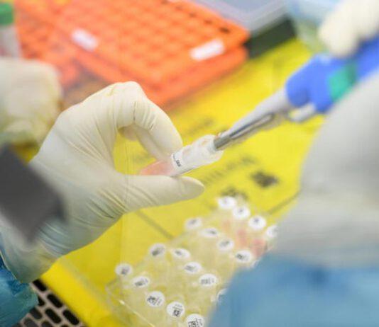 Coronavirus Calabria- 67enne di Catanzaro positivo