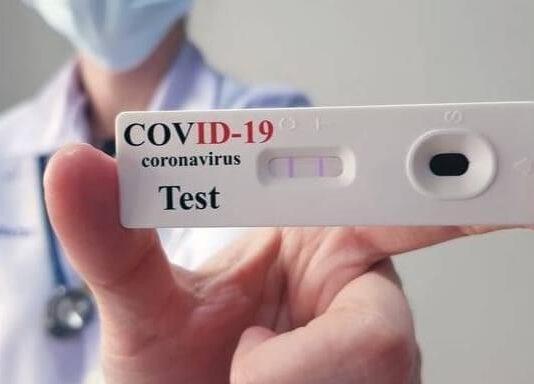 Comune di Melicucco: 250 test rapidi da distribuire a scuole, uffici pubblici e strutture sanitarie