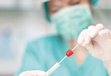 COVID Rosarno- 53 casi nel mese di marzo