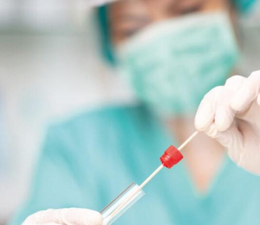 COVID Rosarno- tamponi antigenici rapidi