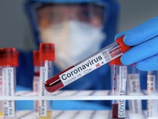 COVID- scende RT nazionale: 5 regioni tornano arancione. Calabria in dubbio