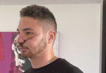 Sfregiato al volto per avere difeso una ragazza – arrestato minore