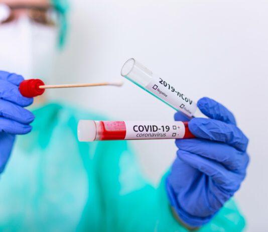 Covid- Aumento dei casi: due comuni in zona rossa