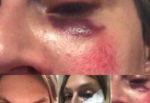 Professoressa in vacanza in Calabria picchiata per aver accudito cani – arrestati in 4