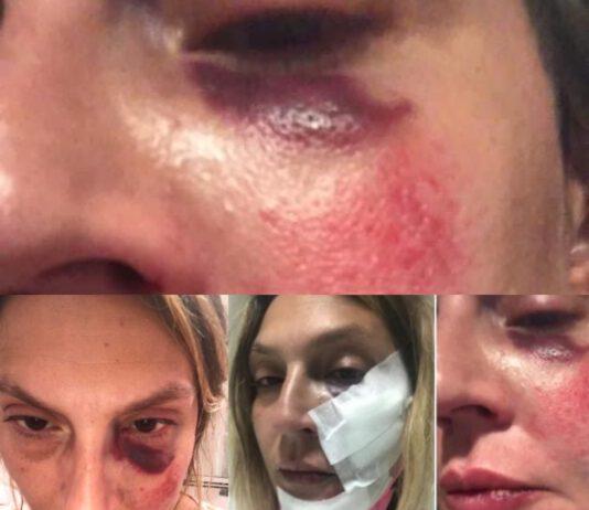 Professoressa in vacanza in Calabria picchiata per aver accudito cani – arrestati in 4