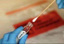 Green pass, Castellone: “Tamponi gratuiti per tutti? Da verificare se fattibile,significherebbe farne più di un milione al giorno.Stiamo lavorando per calmierare ulteriormente i prezzi,ma va scongiurato il rischio di non riuscire a processare i test”