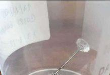 Reggio Calabria: bambino inala ago, soccorso d’urgenza al GOM