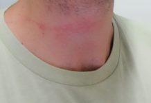 Infermiere di Rosarno aggredito in carcere da detenuto