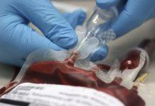 Epatite dopo trasfusione di sangue infetto – risarcimento a famiglia