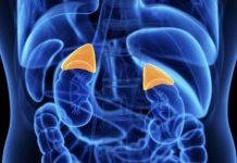 Operata per tumore al surrene sbagliato – la denuncia di una donna