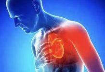 In Calabria oltre 500 vittime di infarto in un anno