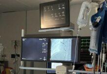 Impiantato pacemaker senza fili al Pugliese-Ciaccio di Catanzaro