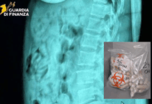 Fermata in aeroporto con 120 ovuli di eroina nello stomaco – arrestata 46enne Guardia di Finanza - Ovuli eroina