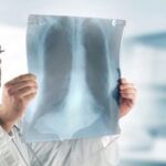 Radiologo accusato di violenza sessuale: fotografava ragazze durante esami