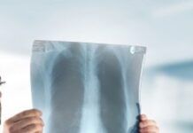 Radiologo accusato di violenza sessuale: fotografava ragazze durante esami