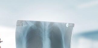 Radiologo accusato di violenza sessuale: fotografava ragazze durante esami