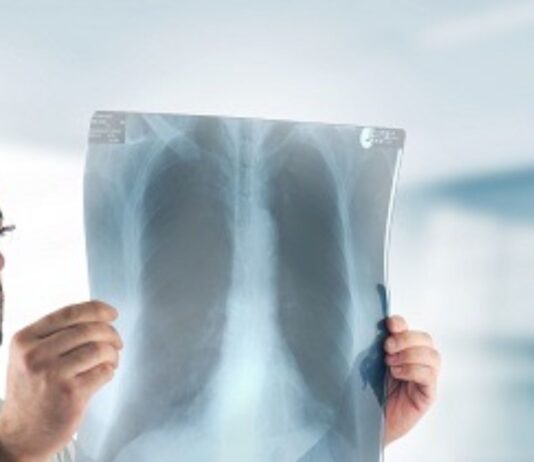 Radiologo accusato di violenza sessuale: fotografava ragazze durante esami