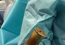 Tolosa, arriva in ospedale con una bomba nel retto: scatta l’allarme e intervengono gli artificieri
