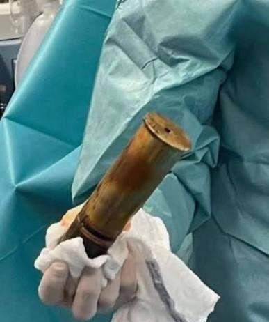 Tolosa, arriva in ospedale con una bomba nel retto: scatta l’allarme e intervengono gli artificieri