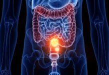 In Calabria il tumore del colon-retto colpisce di più: pochi cittadini fanno lo screening